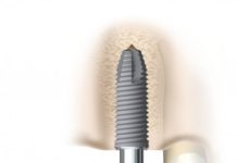 Packaging with lives at stake